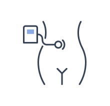 Restore volume to aging vulvas and labia majora