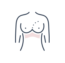 Neck & decolletage rejuvenation